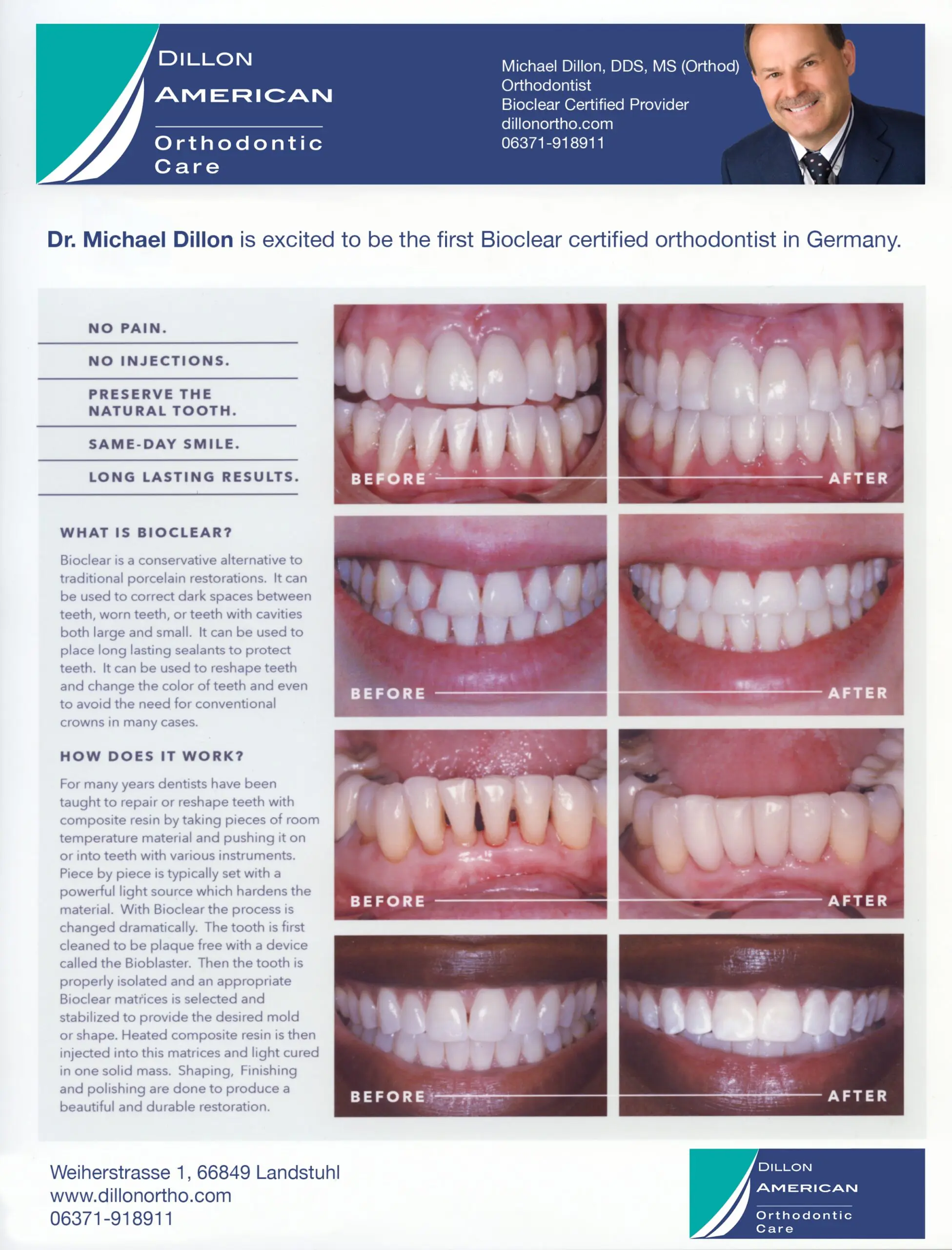 Bioclear