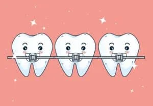 Which Braces Work the Fastest