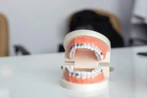 Invisalign vs. braces