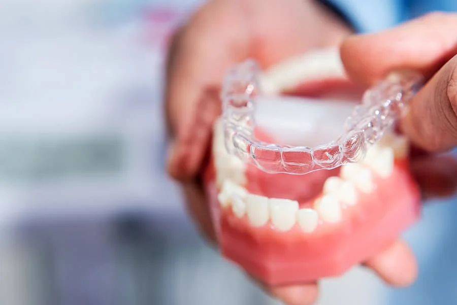 How Does Invisalign Work? The Modern Path to Straight Teeth